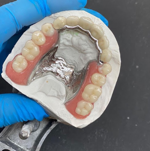 Fabricación de prótesis a medida